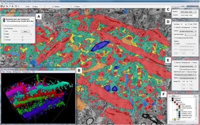 VAST (Volume Annotation and Segmentation Tool): Efficient Manual and Semi-Automatic Labeling of Large 3D Image Stacks